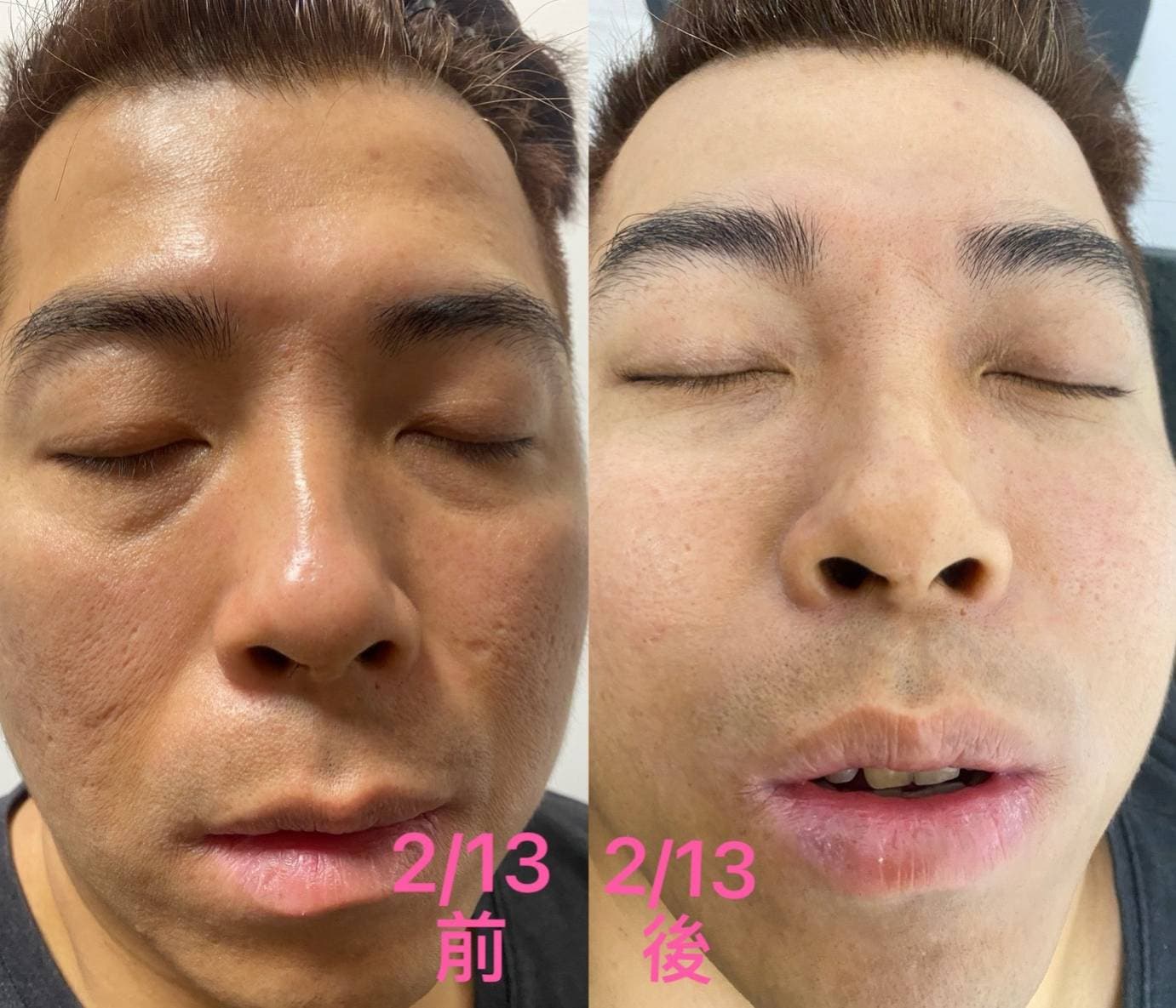 使用前後